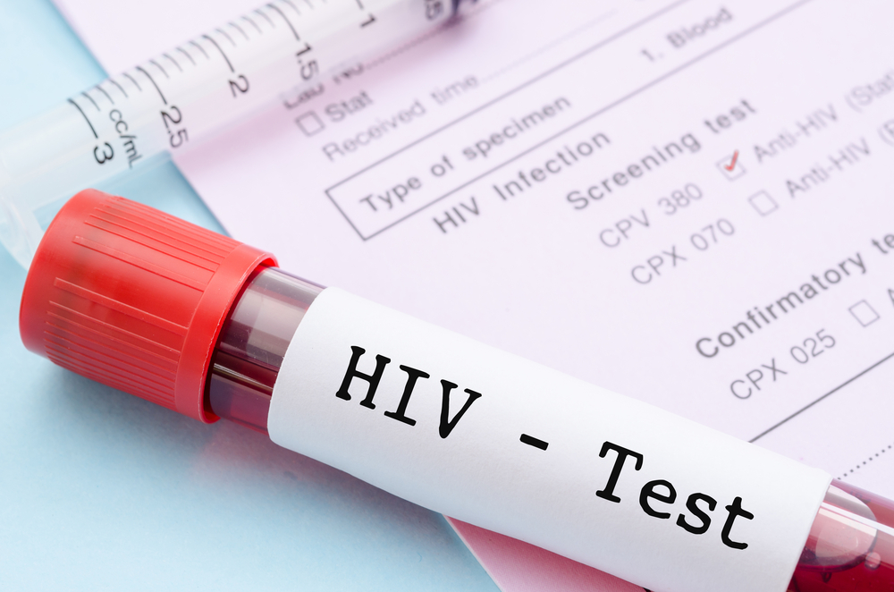 HIV AIDS