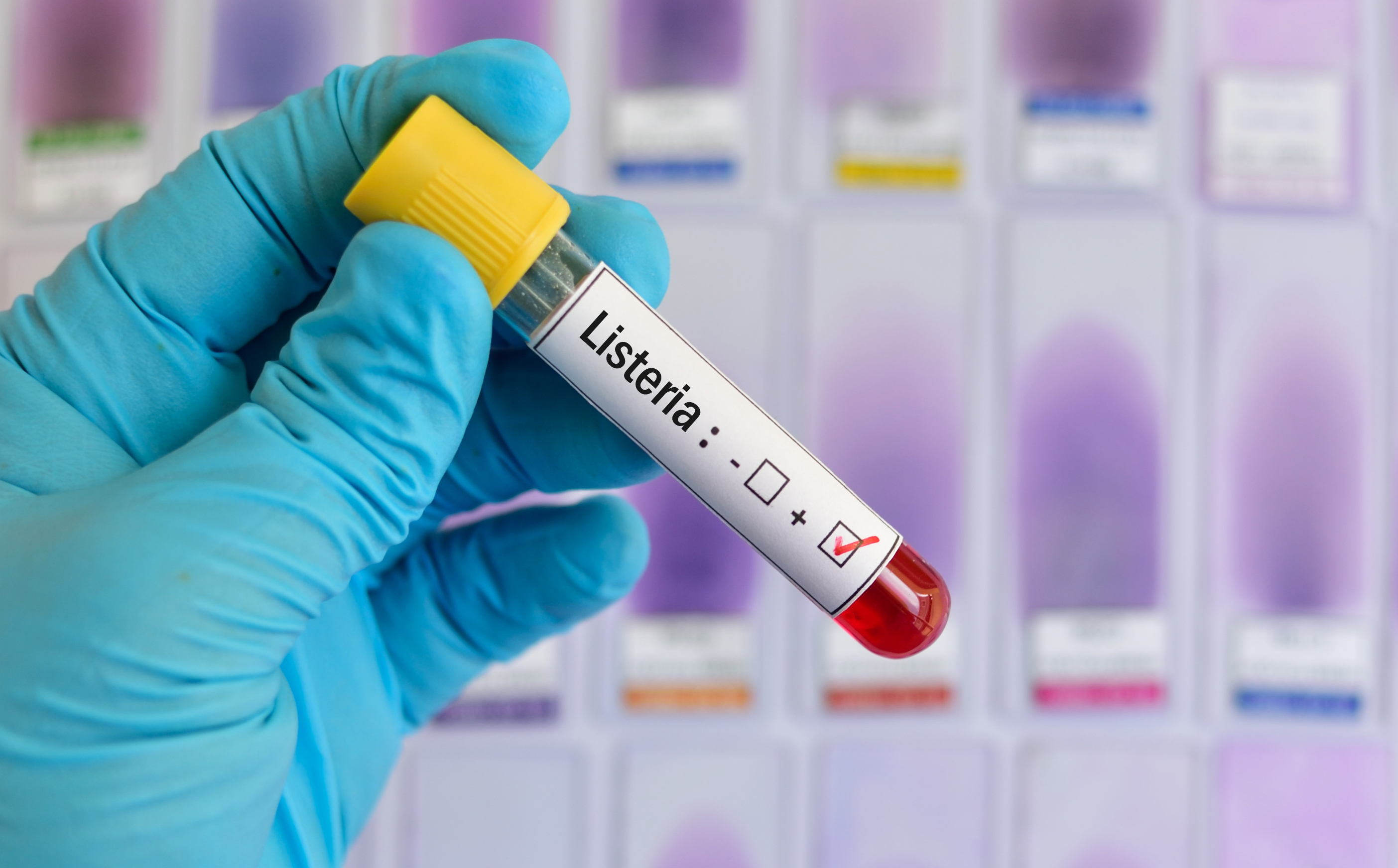 listeria