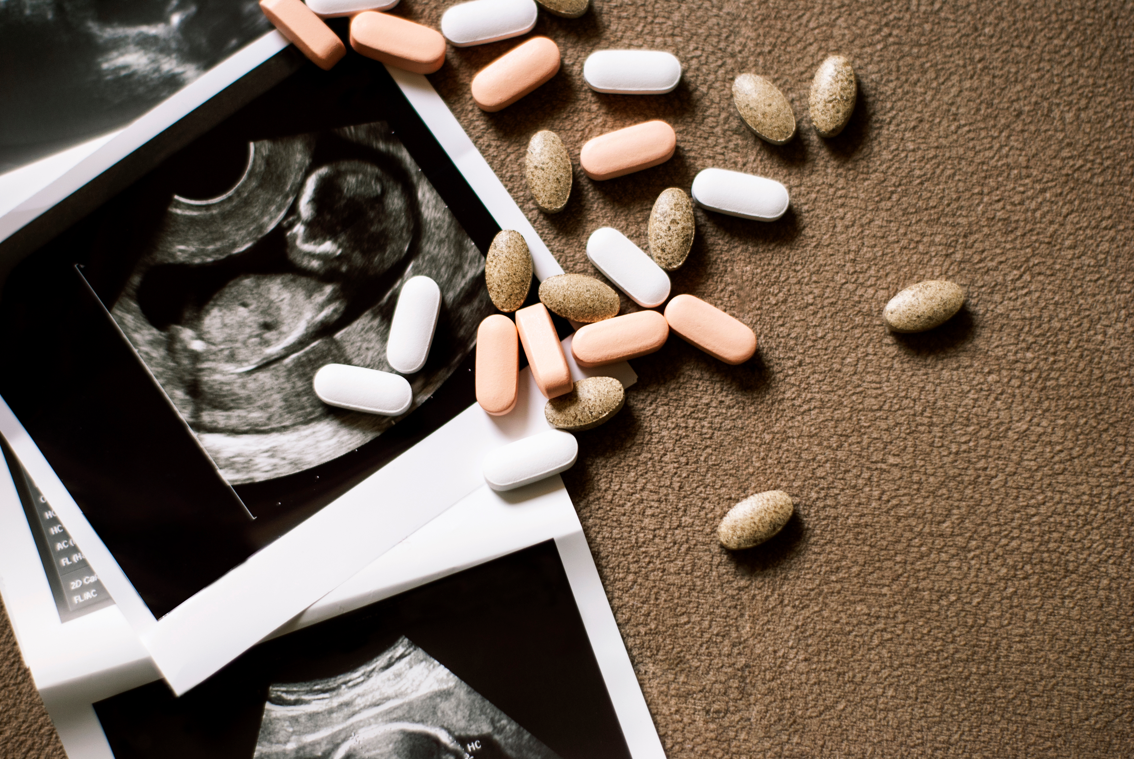 aborto
