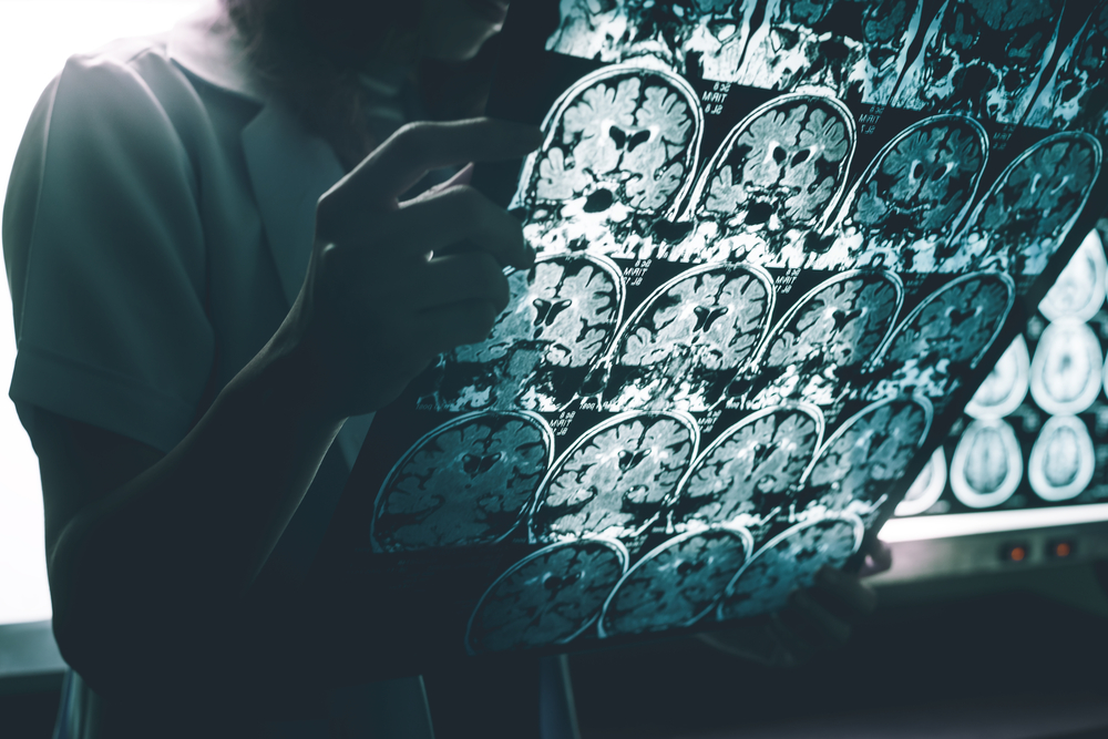 ALZHEIMER