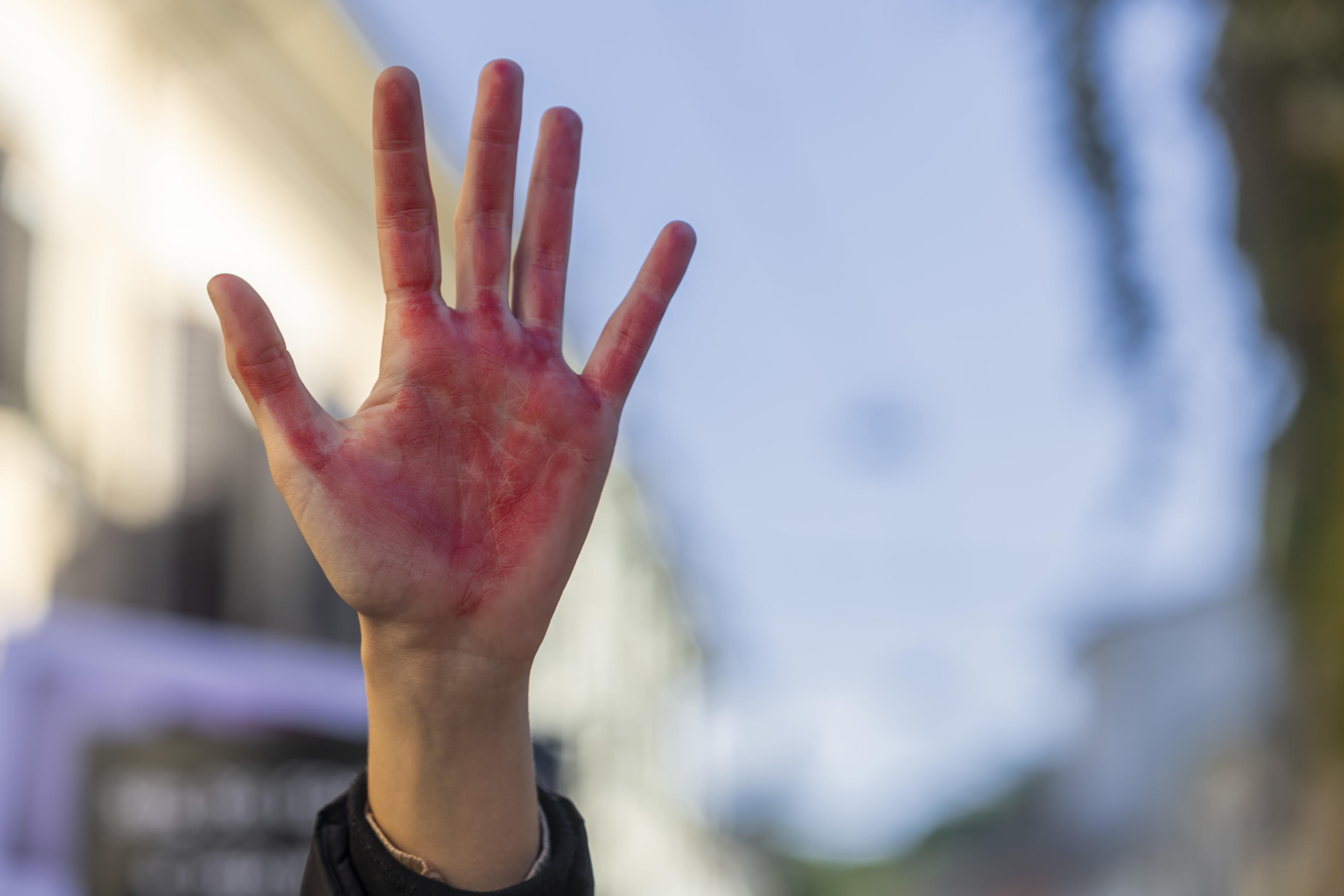 CONTRO VIOLENZA SULLE DONNE